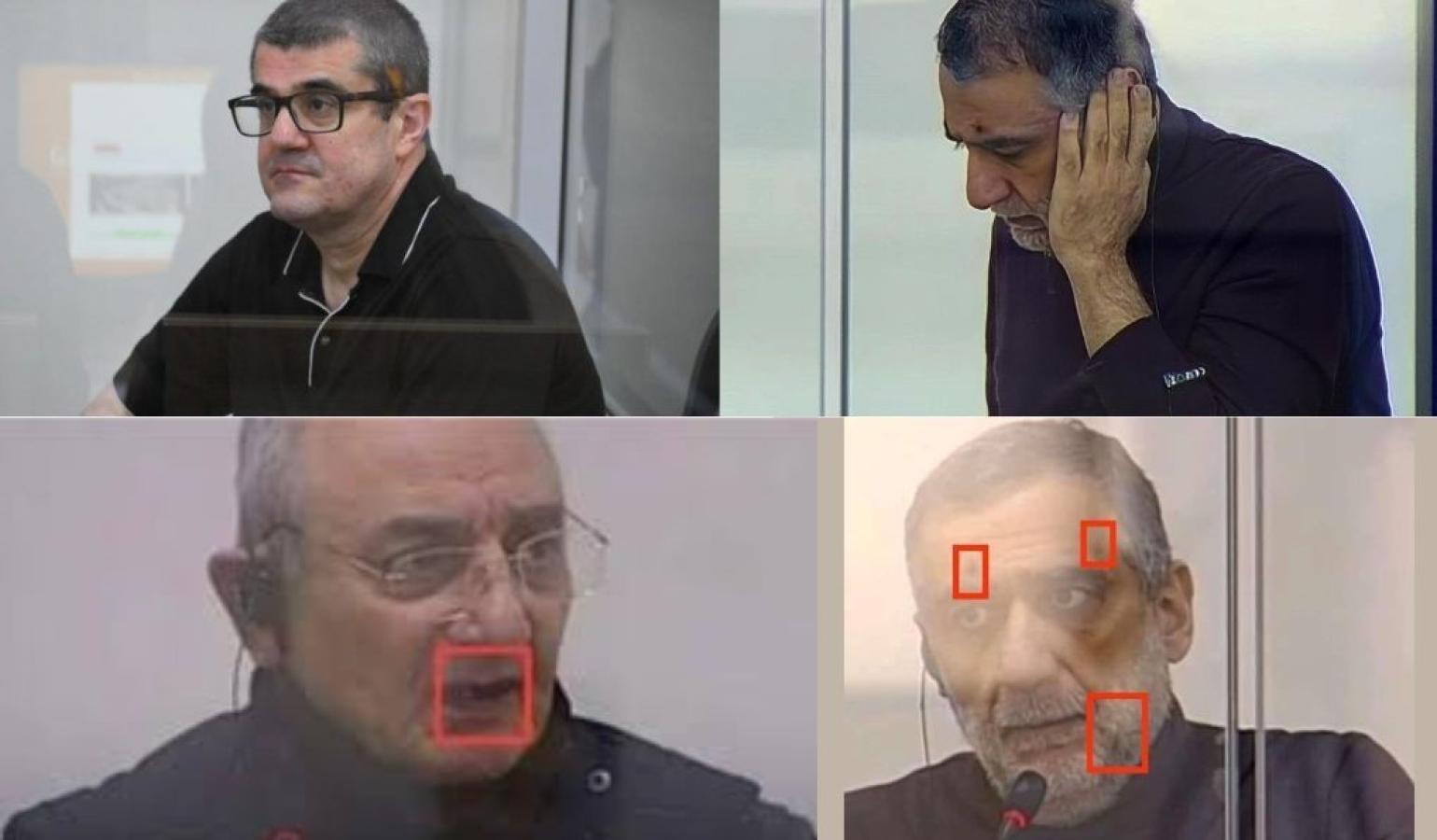 Information about Armenian prisoners held in Baku is being falsified